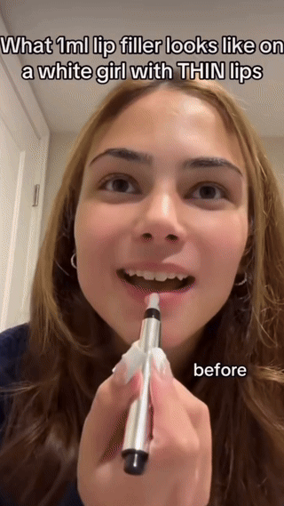 Pout Me Up™ | Bigger lips in 10 minutes